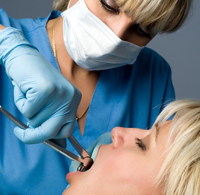 procedure for tooth extractions in Indian Land