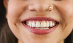 Closeup of woman smiling with Invisalign over teeth