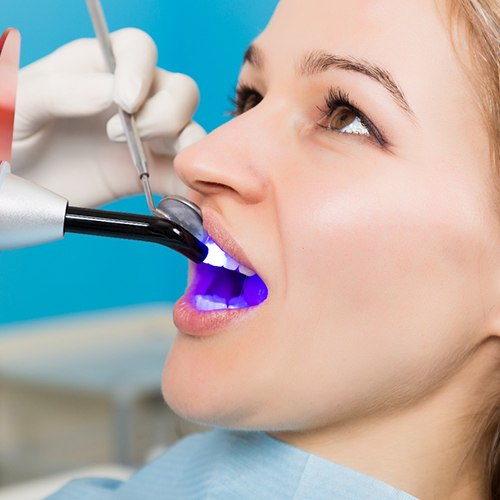 Hardening process of cosmetic dental bonding 
