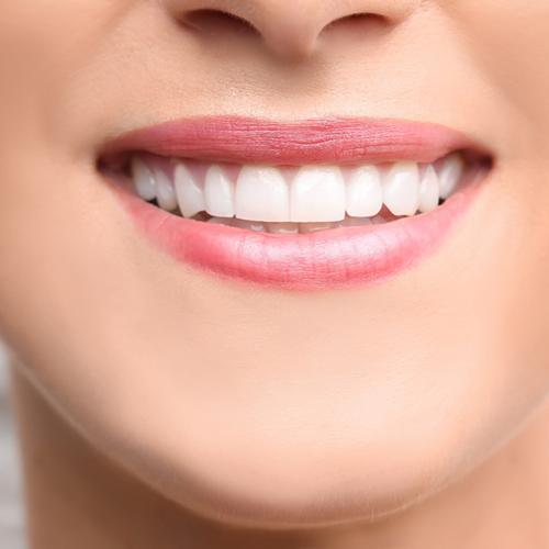 Woman’s beautiful smile after dental bonding 