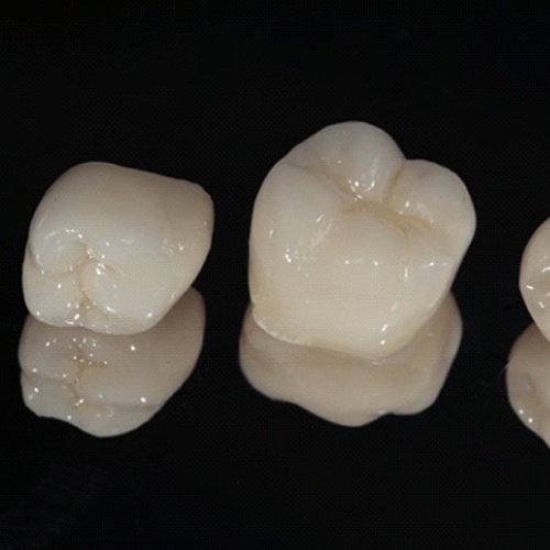 three dental crowns in Indian Land on black background 