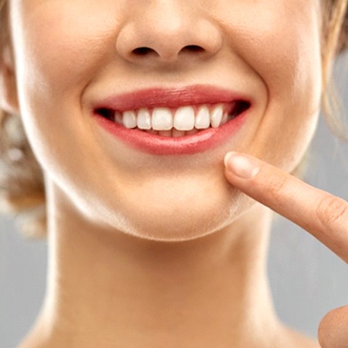 blonde woman pointing to her perfect teeth 