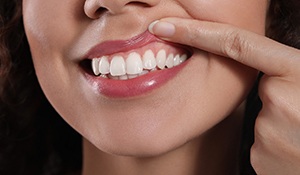  A woman showing her gums