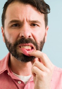 a man near Fort Mill showing signs of gum disease