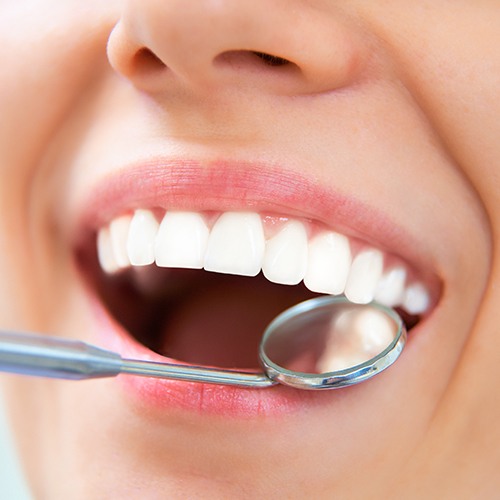 Closeup of healthy smile