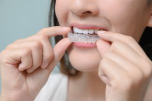 Nose to chin view of a woman with brown hair removing a cloudy aligner tray from her top teeth